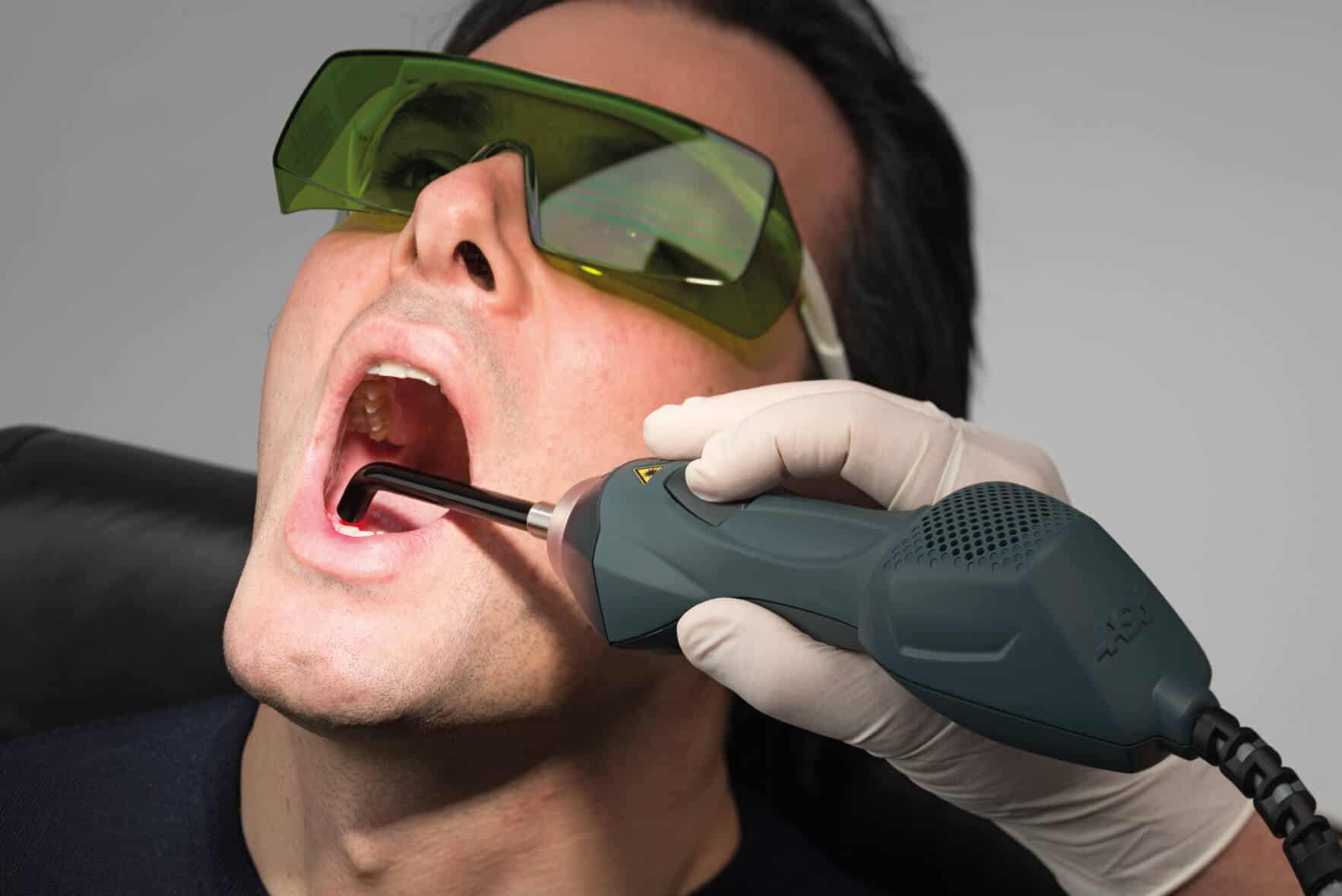 MLS® Laser therapy being used intraorally. It can be used to treat periodontal disease, to accelerate tooth movement in orthodontics, in restorative dentistry, and to treat oral conditions such as oral mucositis, xerostomia, and ulcers.